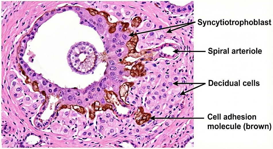 AI generated image of a tissue cross section showing invasion of the spiral arterioles by the cytotrophoblast small